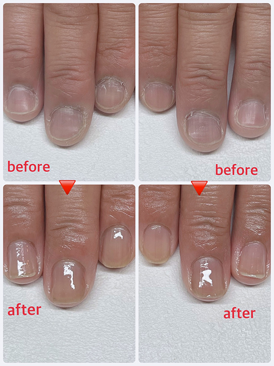 beforeafter2